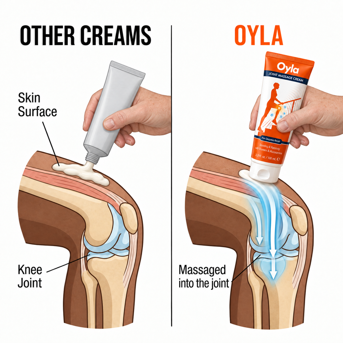 How Oyla is massaged into the whole knee, unlike surface creams